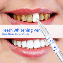 Load image into Gallery viewer, Teeth whitening Pen